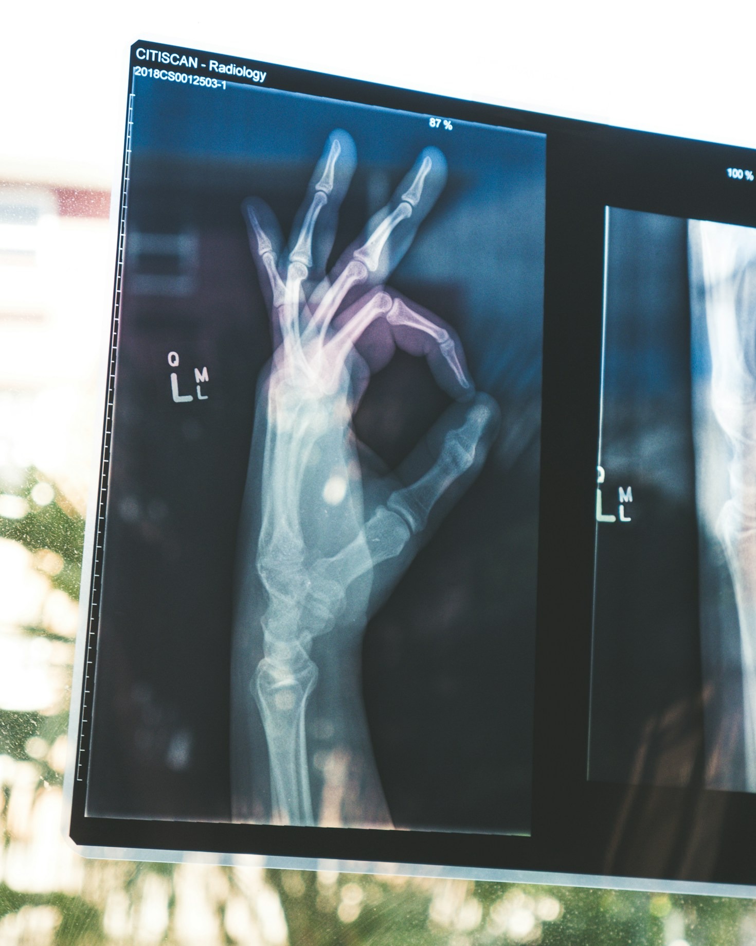 Skillnaden mellan MR-scanning och ultraljud
